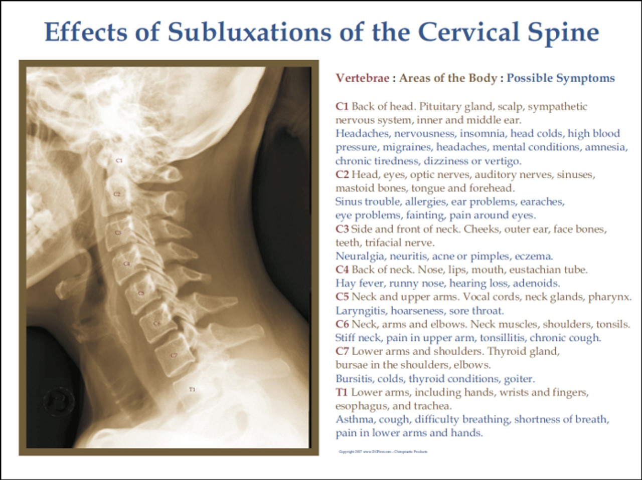 Cervical Spine Subluxation Effects Poster