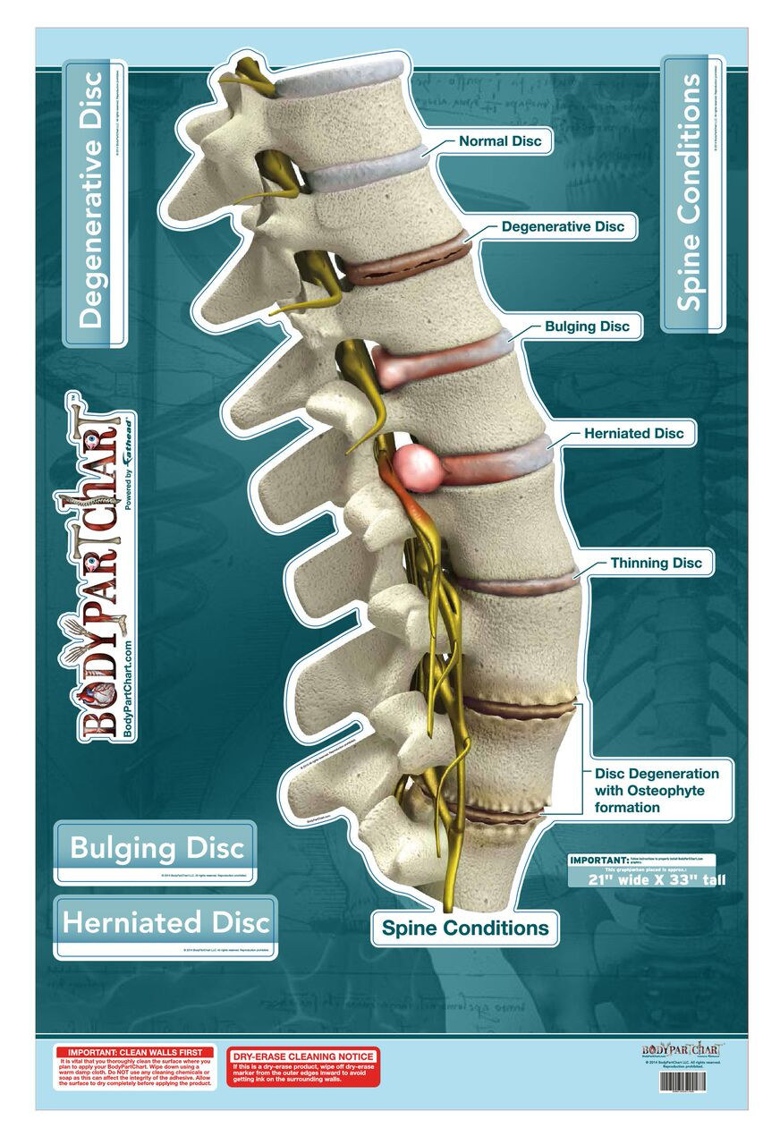 Chiropractic Wall Charts