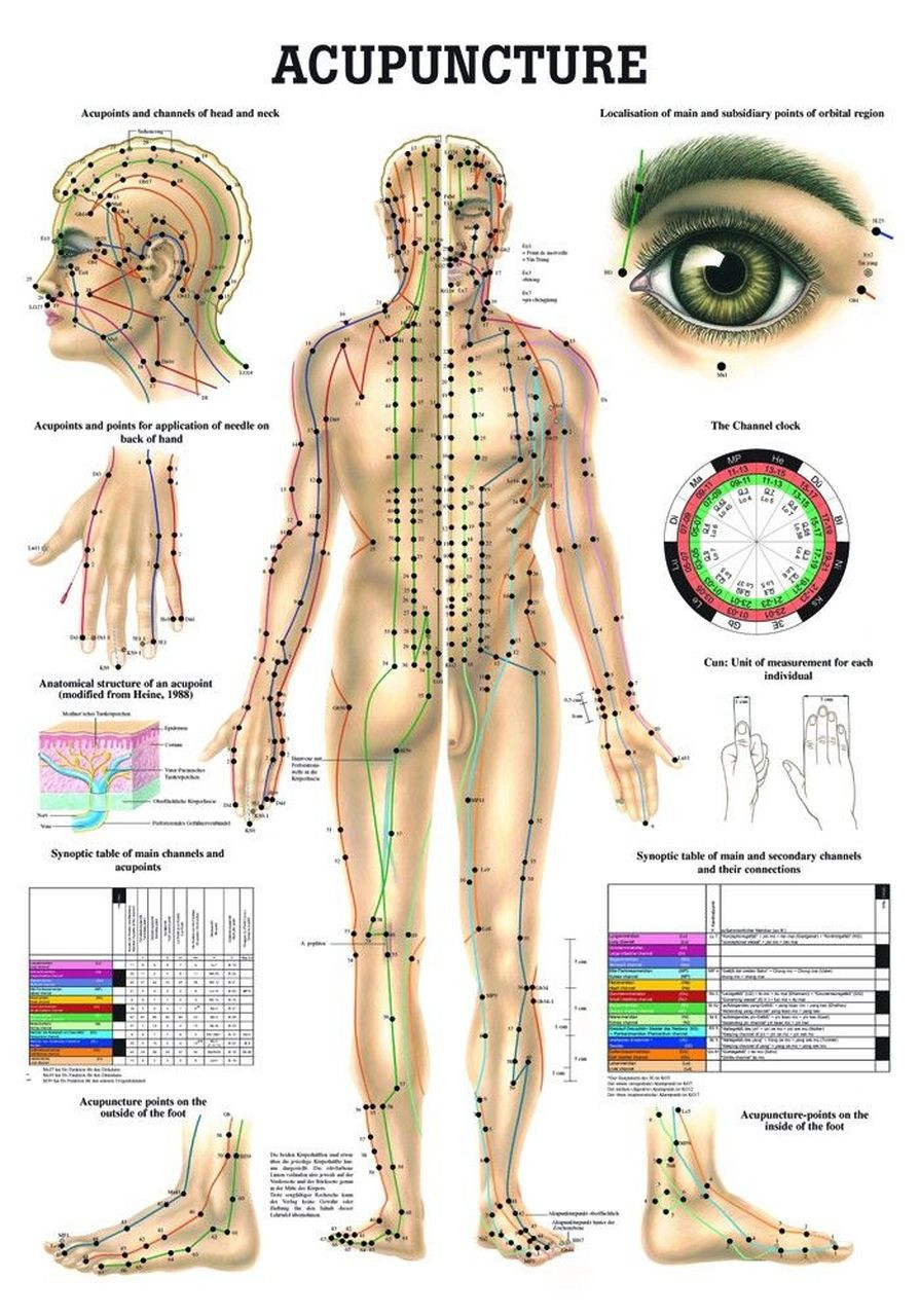 Acupunctura Del Cuerpo