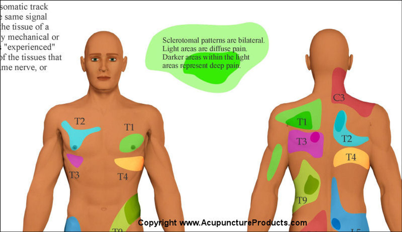 Visceral Referral Patterns Chart