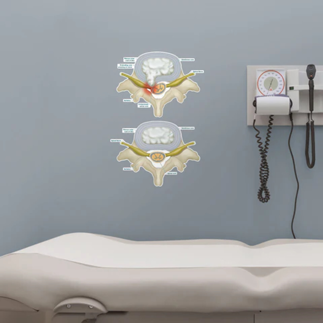 Prolapsed Disc Poster