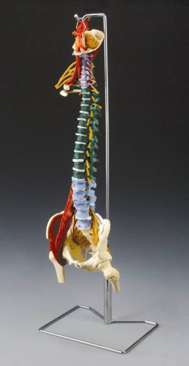 Spine Disorders Vertebrae and Anatomy Model - CH5900