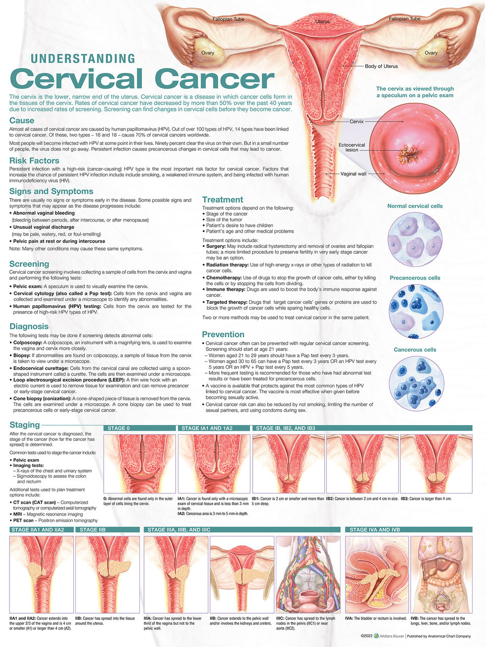 Cervical Cancer Poster