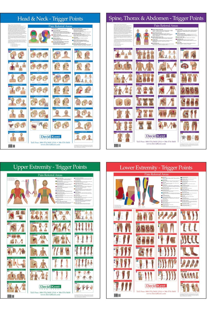 Trigger point Poster set of 4