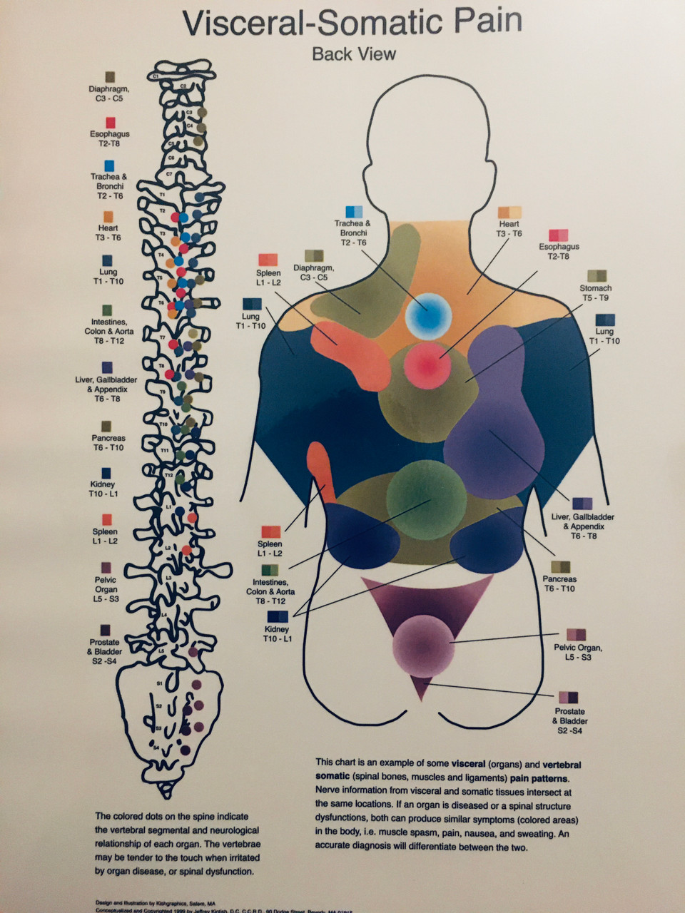 Visceral-Somatic Poster- Back View