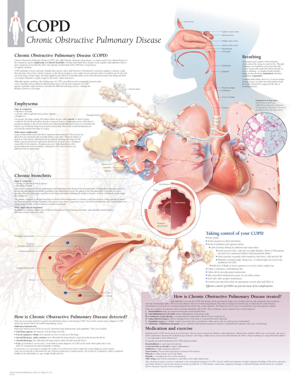 COPD (Chronic Obstructive Pulmonary Disease) Anatomy Poster