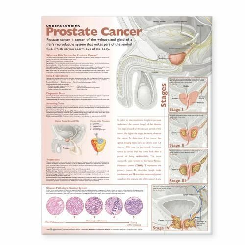 Prostate Poster