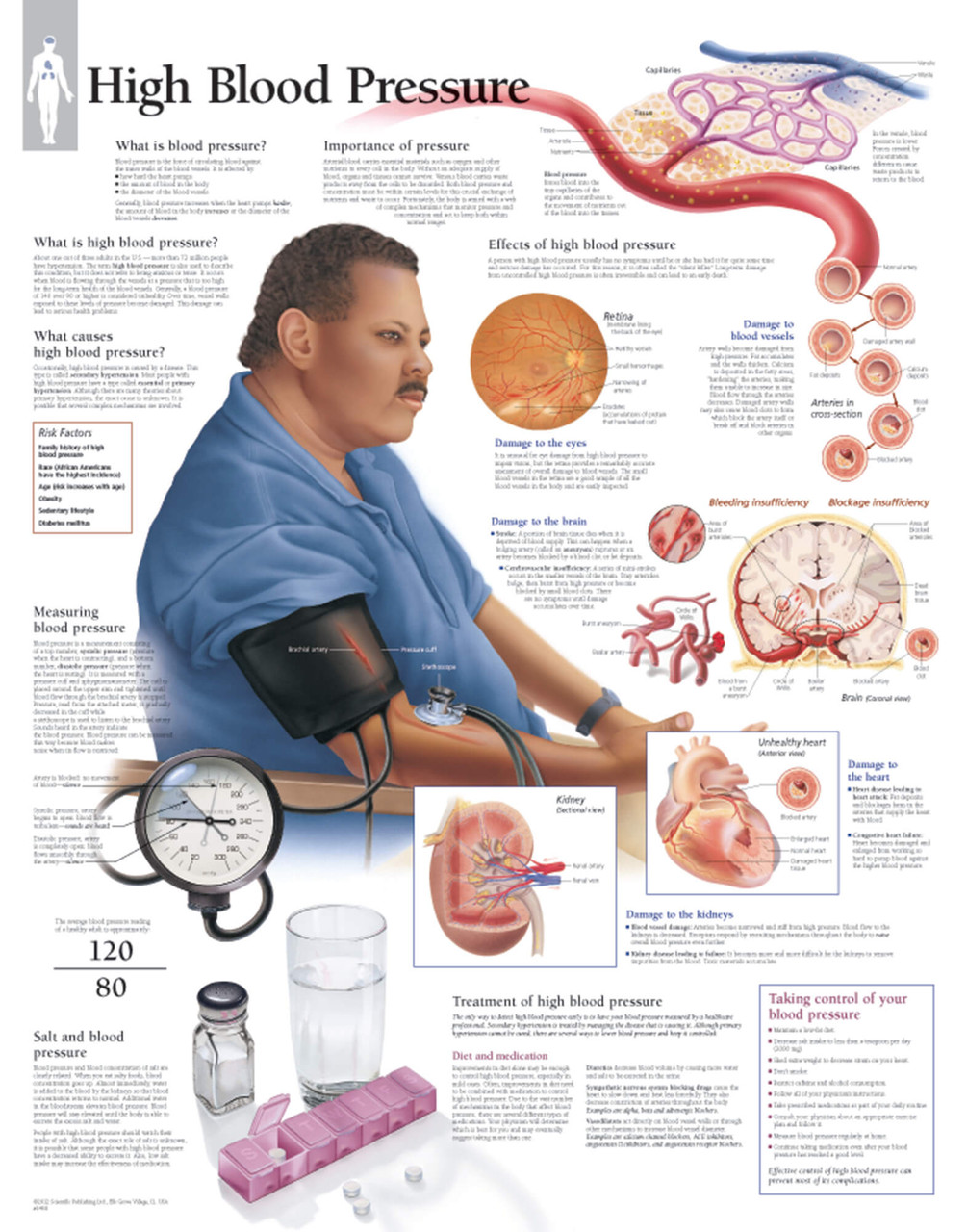 High Blood Pressure Anatomical Poster
