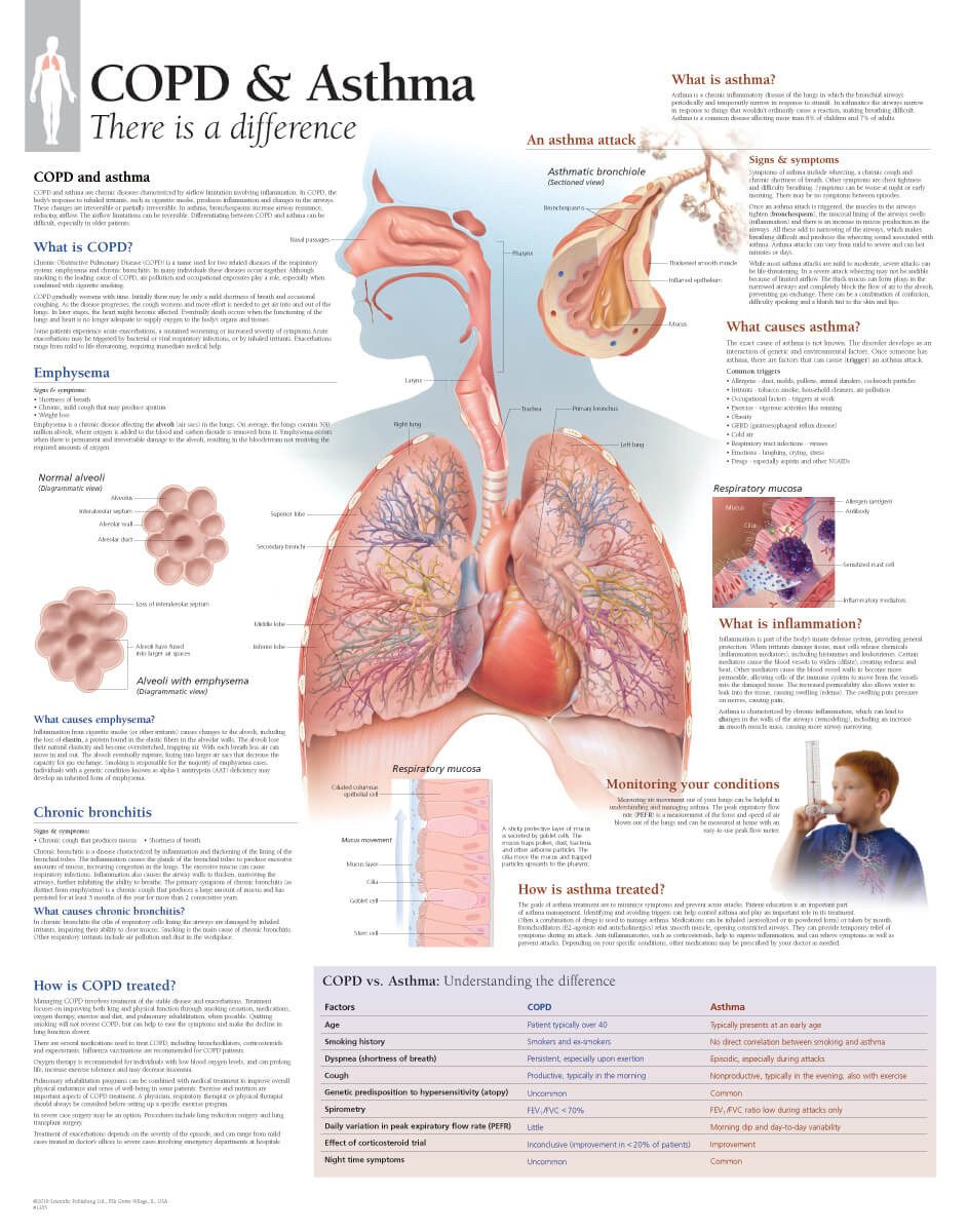 Asthma / COPD Anatomical Chart