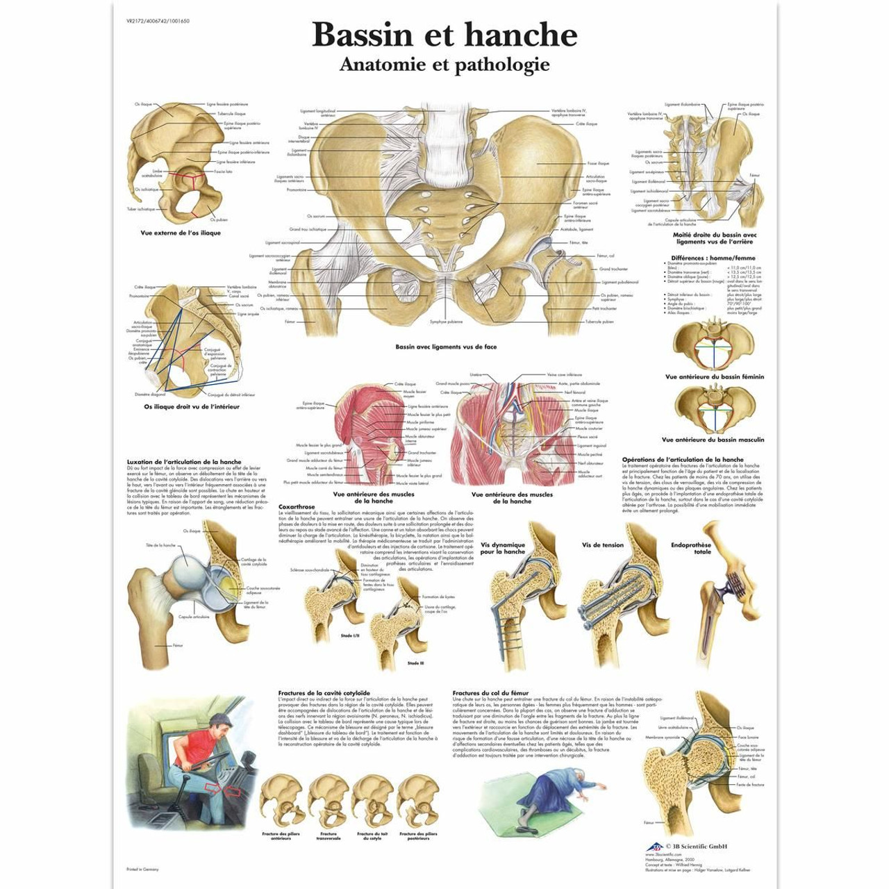 Bassin et hanche - Anatomie et pathologie Chart