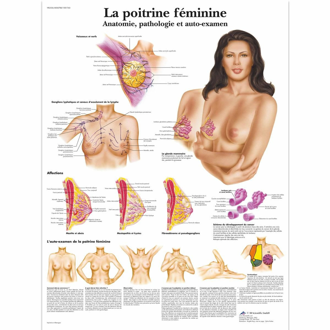La poitrine féminine - et auto-examen Chart