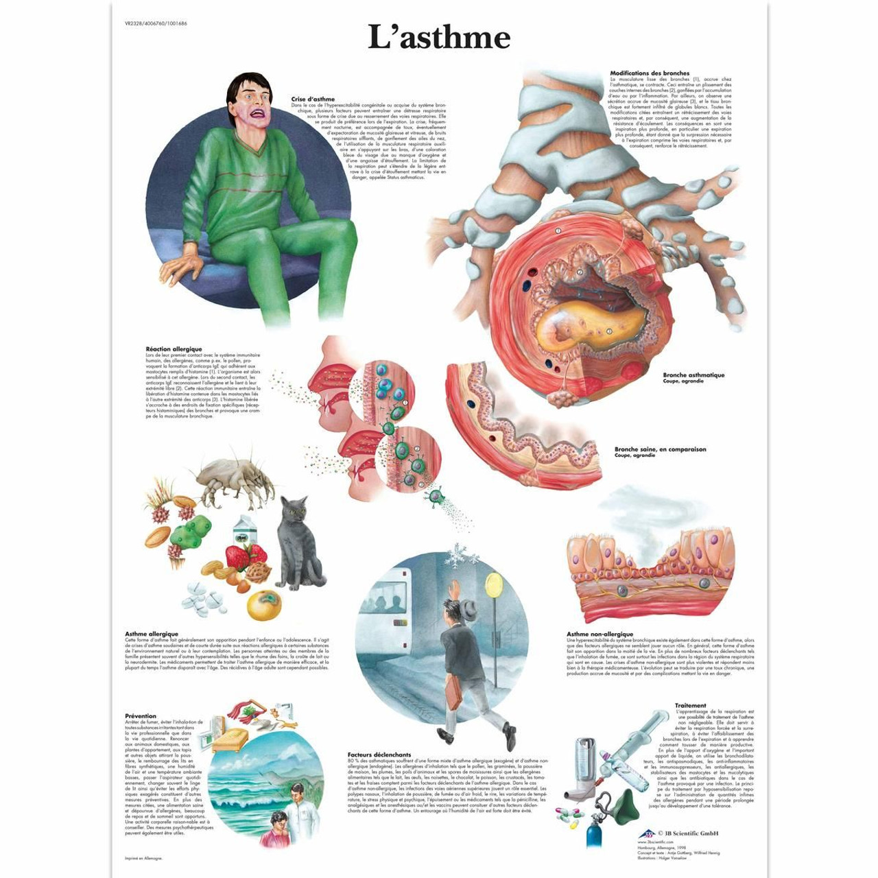 L'asthme Chart