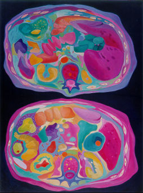 "a la carte" Poster "a la carte" Poster