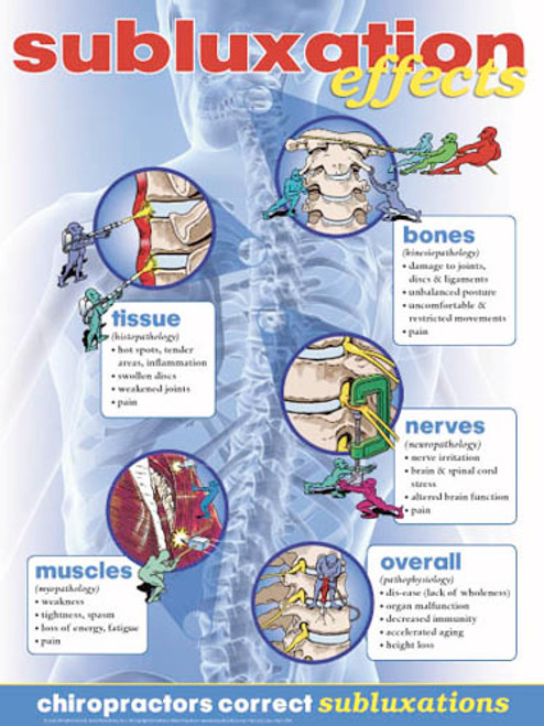 Effects Of Spinal Subluxation Poster Clinical Charts And Supplies 1370