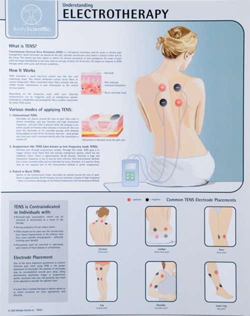 Electrotherapy (EMS) Therapy Poster Electrotherapy (EMS) Therapy Poster