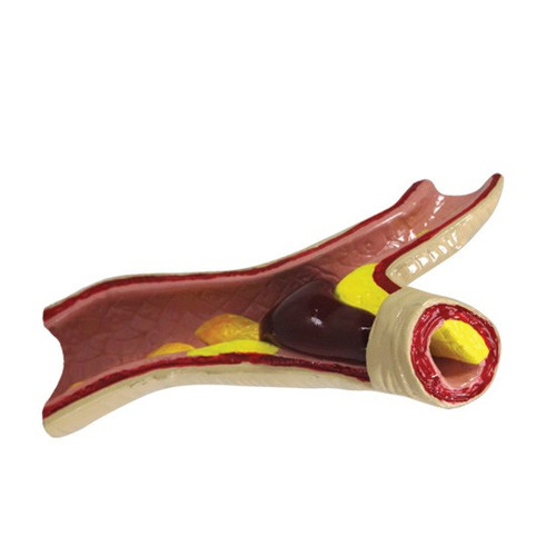 Artery Model