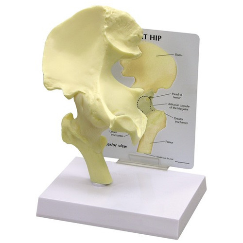 Anatomical Models-Hip, Knee, Ankle, Foot