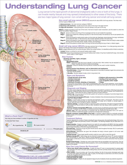 Understanding Lung Cancer Anatomical Chart Understanding Lung Cancer Anatomical Chart