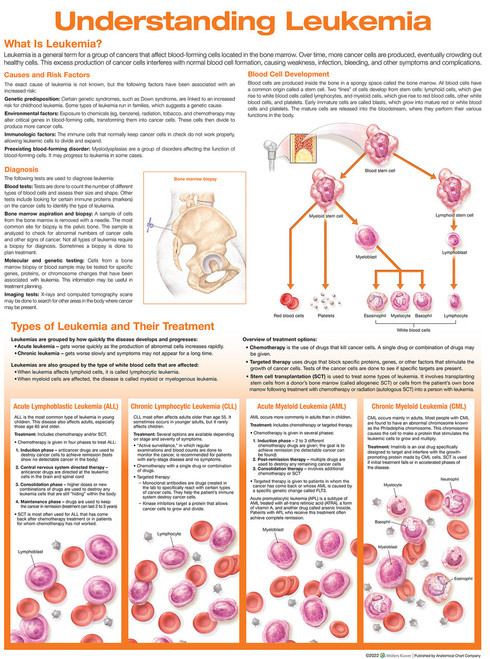 Understanding Leukemia Anatomical Chart Understanding Leukemia Anatomical Chart