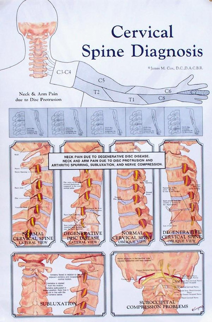 Cervical Spine Diagnosis Anatomy Poster Cervical Spine Diagnosis Anatomy Poster