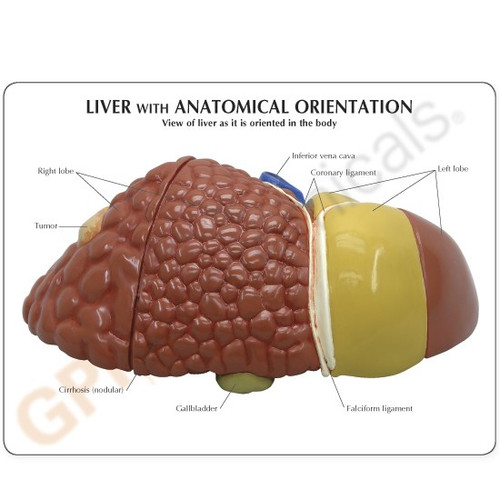 Liver Model Description Card