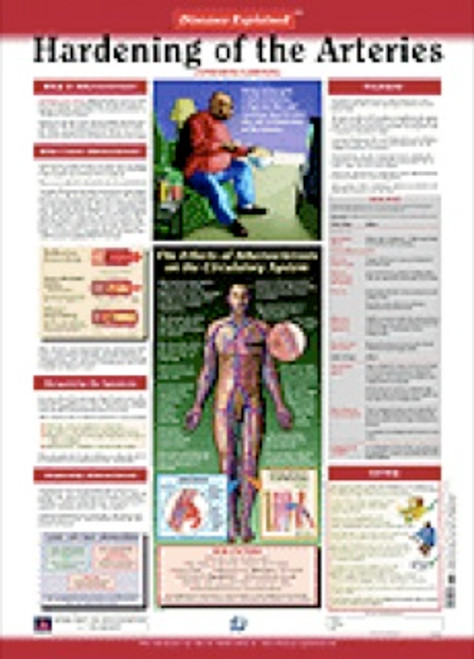 Hardening of the Arteries Anatomy Poster