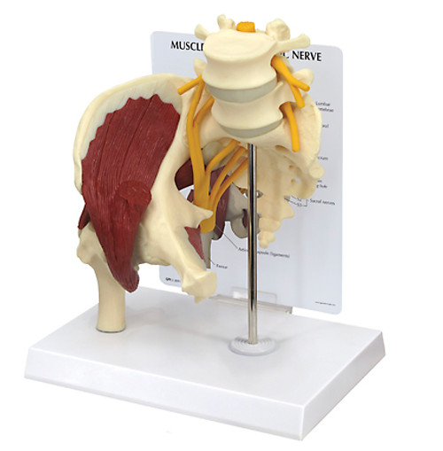 Lumbar Spine,Hip and Sciatic Nerve Anatomical Model
