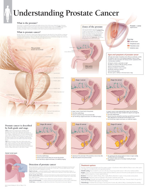 Understanding Breast Cancer Chart