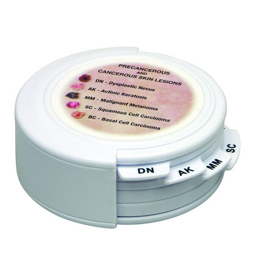 Skin Lesion Model Skin Lesion Model