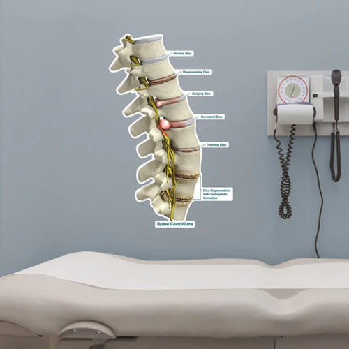 Spine Conditions Wall Poster Spine Conditions Wall Poster