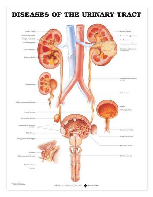 Urinary Tract Poster Urinary Tract Poster