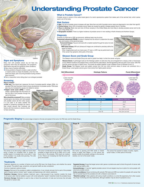 Prostate Cancer Poster Prostate Cancer Poster