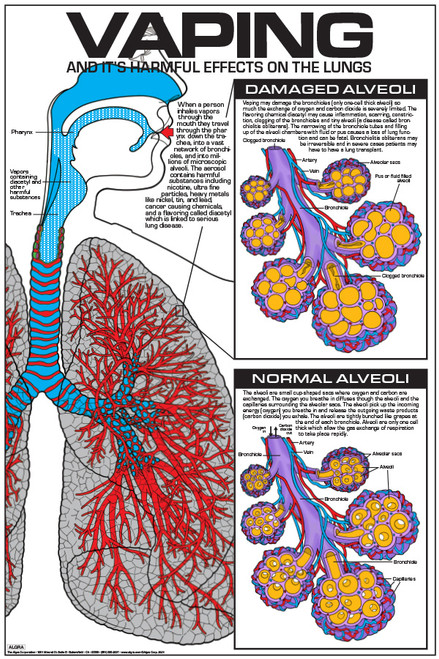 Vaping and the Lungs Poster Vaping and the Lungs Poster