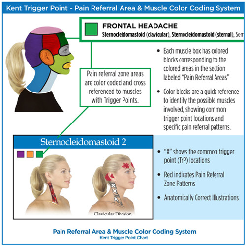 Trigger Points  4 Chart Set