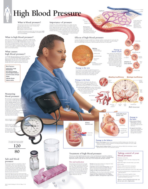 High Blood Pressure Anatomical Poster