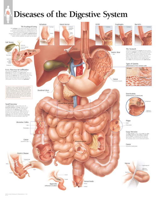 Diseases of the Digestive System Anatomical Poster