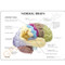 Description card