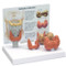 Thyroid Model