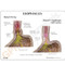 Esophageal Reflux Description Card