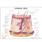 Skin Acne Model Description Card