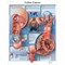 Colon Cancer Poster