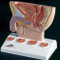 Prostate Model