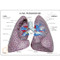 Lung Model Description Card