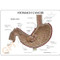 Stomach Model Description Card
