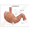 Stomach Model Description Card