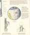 Myofascial Pain Syndrome Poster