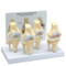 Osteoarthritis Knee Model