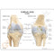 Osteoarthritis Knee Model Description Card