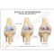 Osteoarthritis Knee Model Description Card