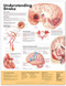 Stroke Poster